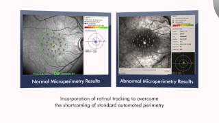 The Optos OCT SLO Imaging System for Retinal Analysis [upl. by Aloap718]