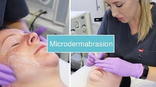 Microdermabrasion  The Laser and Skin Clinic [upl. by Audly]