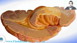 Ventricles of Brain  2  Lateral Ventricle [upl. by Aititil]