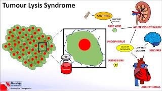 Tumour Lysis Syndrome [upl. by Meer]