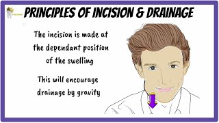 Basic Principles of INCISION and DRAINAGE [upl. by Assedo]