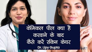 Chemical Peel Benefits and Side Effects केमिकल पील करवाने के बाद कैसे करें Skin Care  NBT [upl. by Jacquenette848]