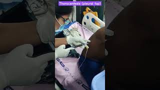 Pleural Tapping l Thoracentesis medical nursing surgery icu procedures trending injection [upl. by Duomham765]