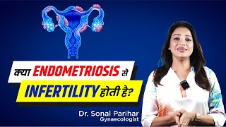 Endometriosis amp Infertility  Medicine ya surgery  Kya better option Hai  Sonal Parihar [upl. by Una861]