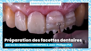 🦷 Les facettes dentaires  létape de la préparation avec les Drs CONTREPOIS et PIA [upl. by Lleda]