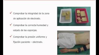 umh1723 201213 Lec015a Electrodiagnóstico de estimulación Metodología de las curvas I  t [upl. by Kipper]