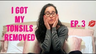 I GOT MY TONSILS REMOVED AT 21 TIPS amp RECOVERY VLOG2019 [upl. by Costin]