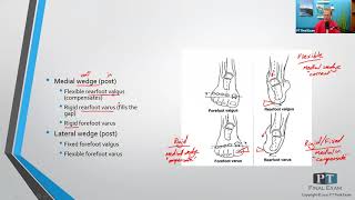 Forefoot and Rearfoot Deformities [upl. by Joyann]