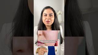 How to treat open pores dermatologist recommended skincare tips for openpores shorts viral shorts [upl. by Allebasi]