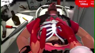 Surgeon Simulator 2013 WITH RAZER HYDRA A [upl. by Cressy]