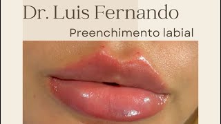 PREENCHIMENTO LABIAL [upl. by Vieva113]