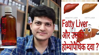 Fatty liver  Homeopathic Medicine for Fatty liver  My Combination [upl. by Diahann]