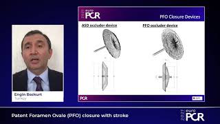 Patent Foramen Ovale PFO closure with stroke  EuroPCR 2021 [upl. by Assi]