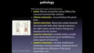 Retroperitoneal Fibrosis [upl. by Mccourt519]