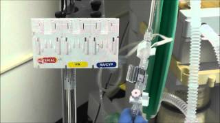 How to Setup an Arterial Line Transducer [upl. by Amahcen]