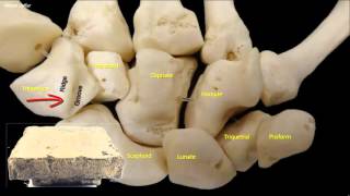 Osteology of the hand [upl. by Marchal]