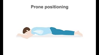 How to treat your intubated ARDS patients with prone positioning [upl. by Glen]