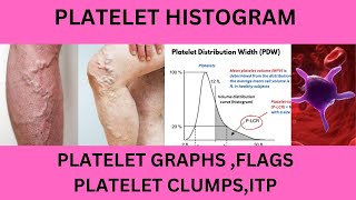 PLATELET HISTOGRAMPLATELET GRAPHPLATELET INDICESPLATELET FLAGSPLTPLT LCRPLTMP FLAGPUPL FLAG [upl. by Derfiniw]