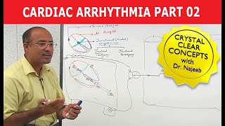 Cardiac Arrhythmia  Part 23 [upl. by Penni]