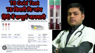 Quantiferon TB Gold test in Hindi  टीबी मरीजों के लिए TB gold टेस्ट क्या है  Result amp Normal value [upl. by Etteneg357]