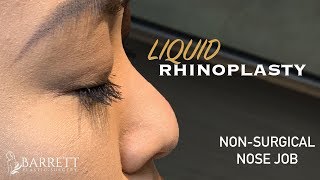 Liquid Rhinoplasty  Non Surgical Nose Job  Barrett Plastic Surgery  Beverly Hills [upl. by Ojadnama]