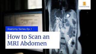 How to Scan an MRI Abdomen [upl. by Yendys826]