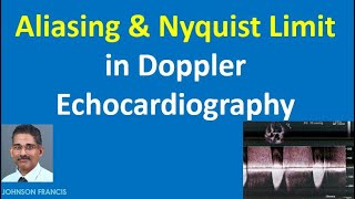 Aliasing and Nyquist Limit in Doppler Echocardiography [upl. by Wehttan281]