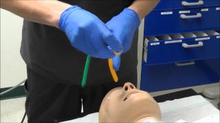 Nasal Intubation [upl. by Addiego]