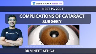 Complications of Cataract Surgery  NEETPG 2021  Vineet Sehgal [upl. by Htenywg]