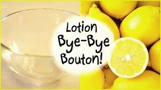 DIY Acné • Lotion Bye Bye Bouton [upl. by Niobe283]