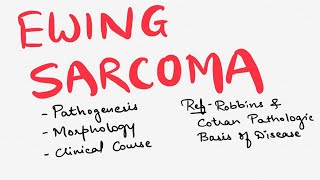 Ewing Sarcoma  Bone Tumors  Pathology of Ewing Sarcoma  General Pathology Bone Tumors [upl. by Drucill]