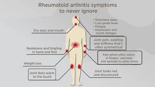 Rheumatic Diseases [upl. by Mathew]