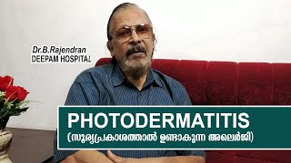 PHOTODERMATITIS  MEDI TALK  DR B RAJENDRAN  DEEPAM HOSPITAL [upl. by Denis]