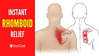 How to Fix Rhomboid Pain FOR GOOD [upl. by Enirhtak777]