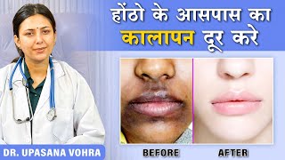 How to Remove Pigmentation Around the Mouth Upasana Ki Duniya [upl. by Ishmael402]