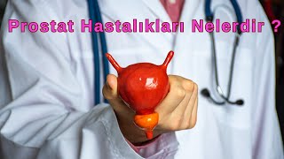 Prostat Hastalıkları Nelerdir   İyi Huylu Prostat Büyümesi  ProfDr Oğuz Acar [upl. by Aerdnahs702]