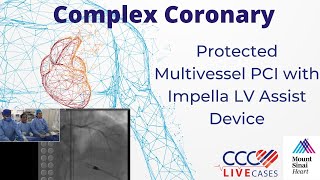 Protected Multivessel PCI with Impella LV Assist Device  CCC Live March 2017 [upl. by Harrad]