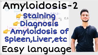 Amyloidosis Pathology 2 Staining characterstics of Amyloid Amyloidosis of spleenliverkidney etc [upl. by Salazar715]