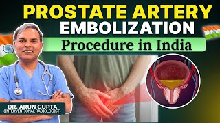 Prostate Artery Embolization PAE Procedure in India  Treatment Overview [upl. by Tali]