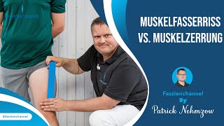 Muskelfasserriss VS Muskelzerrung – Wie Du es erkennst und unterscheiden kannst [upl. by Artemed]