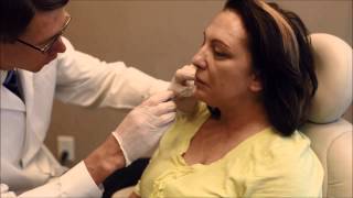 Patient Receives Juvederm Ultra Plus XC Treatment [upl. by Marie-Jeanne]