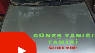 Güneş Yanığı Nasıl Düzelir Boyasız Verniksiz düzelir mi Bilmeniz Gerekenler [upl. by Raeann482]