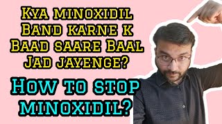 How to stop minoxidil Which minoxidil is best for hair regrowth Isko band krne se hairfall hota h [upl. by Eltotsira371]