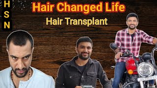 Hair Transplant result in Telugu HSN Hair transplant review  4 months completed [upl. by Eiro480]