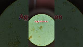 Cross match blood reaction when two different blood samples mixsimple way of cross match [upl. by Aiker]