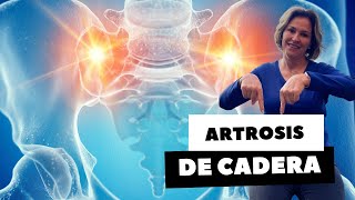 ARTROSIS DE CADERA PARTE 1 [upl. by Punak464]