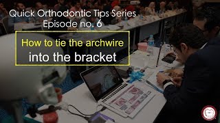 figure8 O tie and ligature tie episode no6  Quick orthodontic tips [upl. by Zinnes]