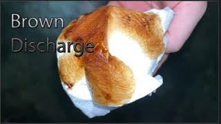 What Is Brown Discharge Before Periods [upl. by Elleahcim844]