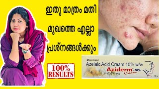 AzidermAzelaic acid cream for clear and glowing skin in 7 daysAshmiAshmi [upl. by Burwell]