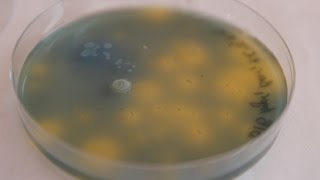 DIY BIO How to obtain Acetobacter amp making Bromothymol blue Agar [upl. by Nameerf706]